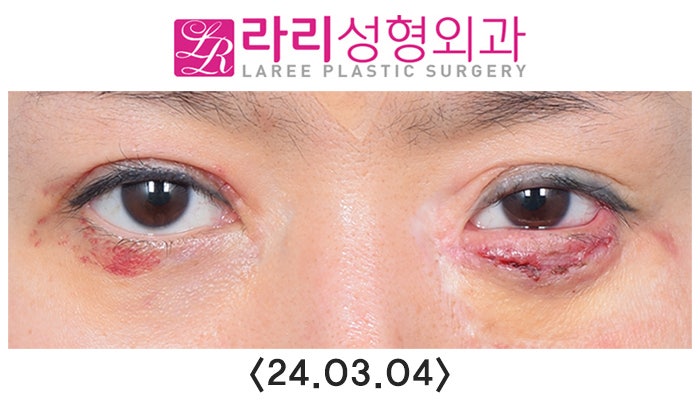 임2.jpg