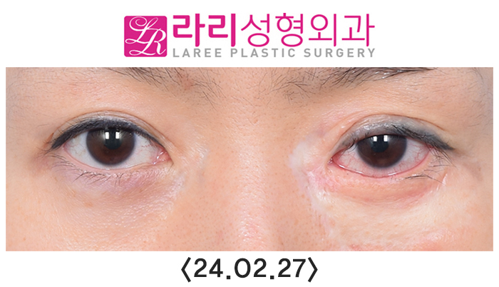 임1.jpg