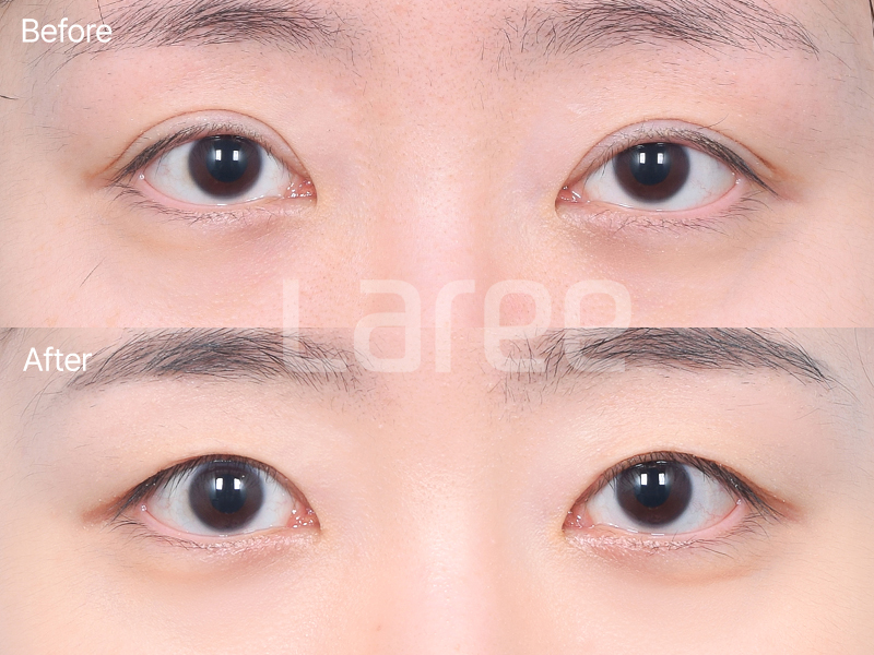 902df0be70054.png