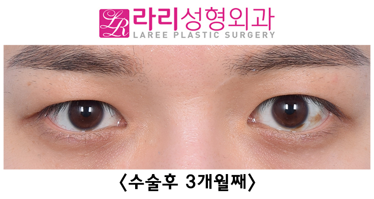 호2.jpg
