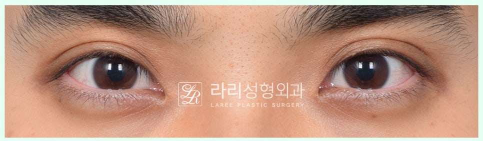 SE-a5fda84d-dd3f-4135-89df-19c8ed44839e.jpg