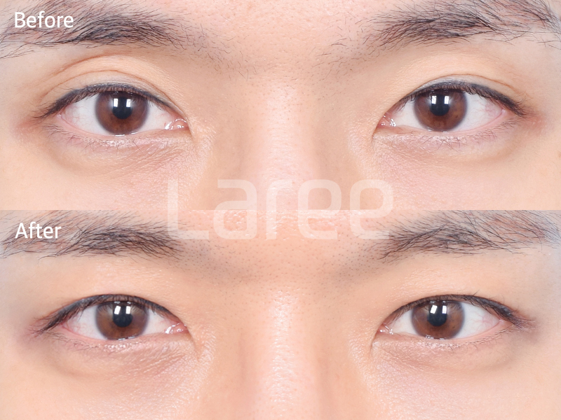 d2410972a28e0.png