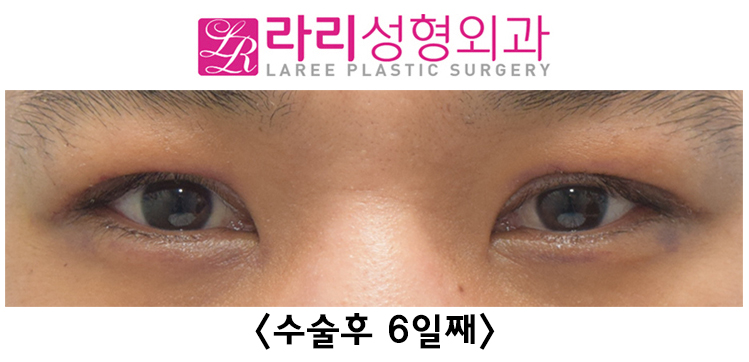 영2.jpg