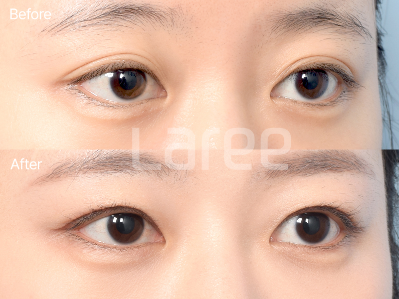 dfc5a7f48eef9.png