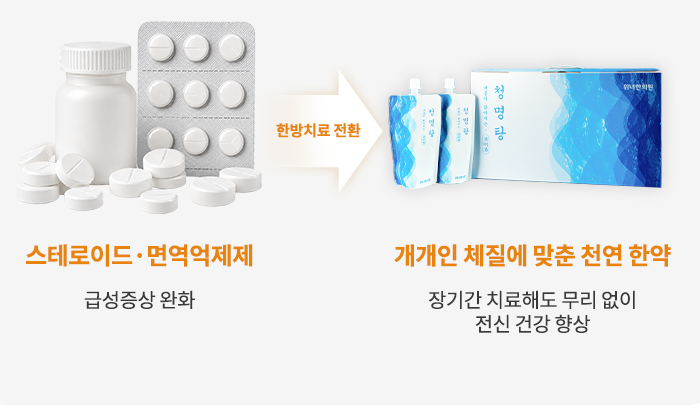 스테로이드·면역억제제에서 천연 한약으로 전환