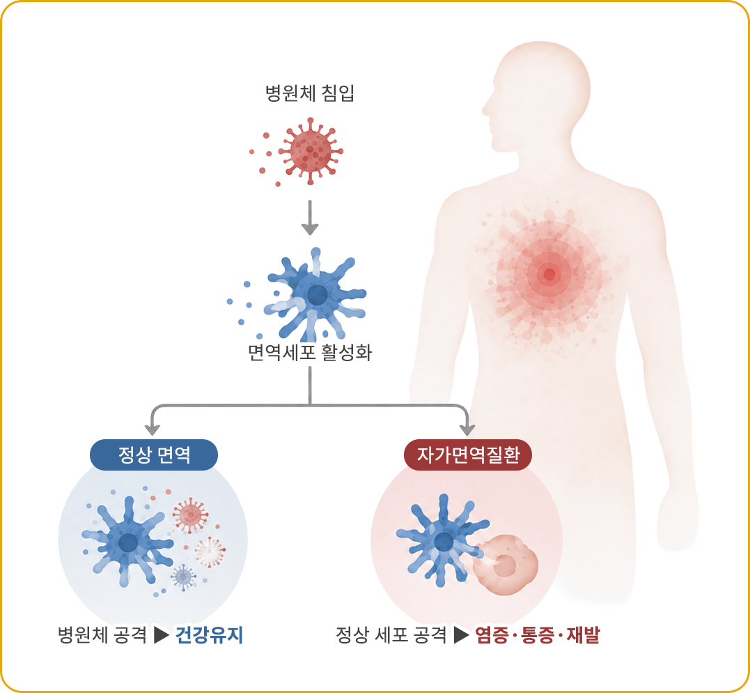정상 면역과 자가면역질환의 차이