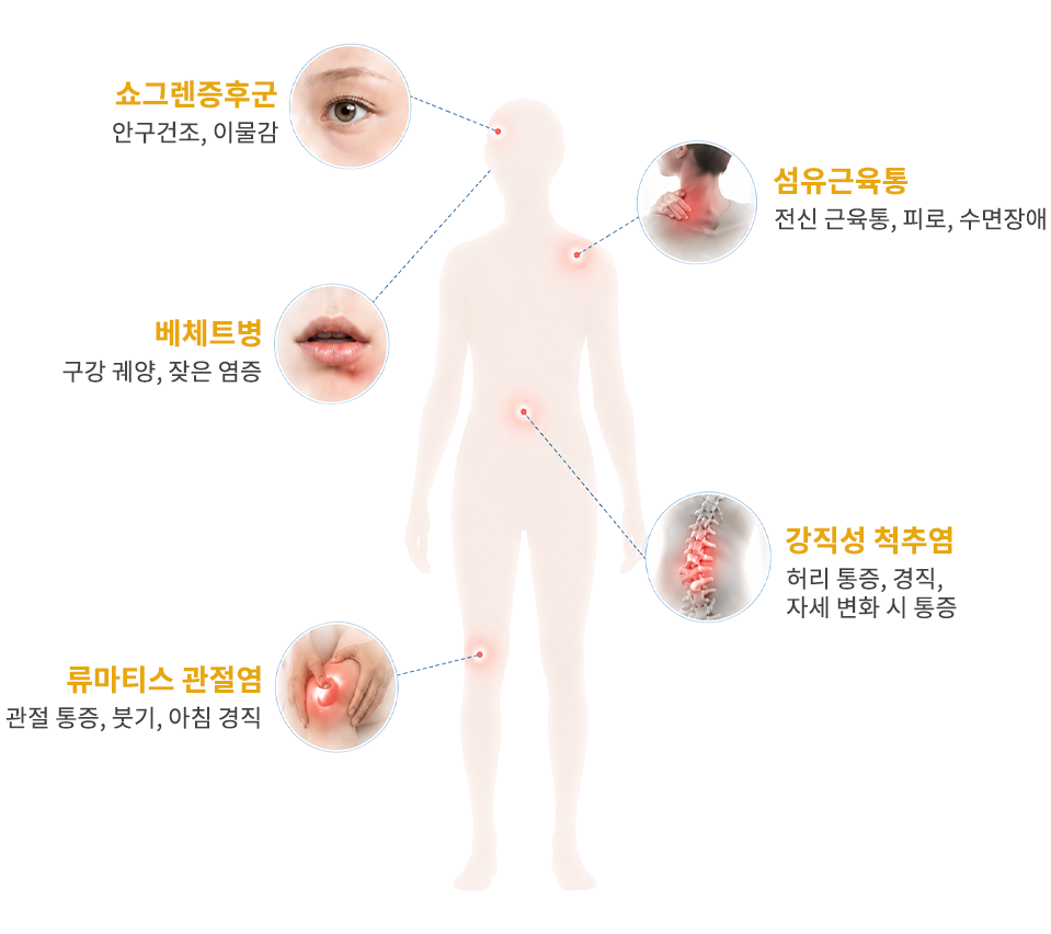 자가면역질환의 다양한 증상