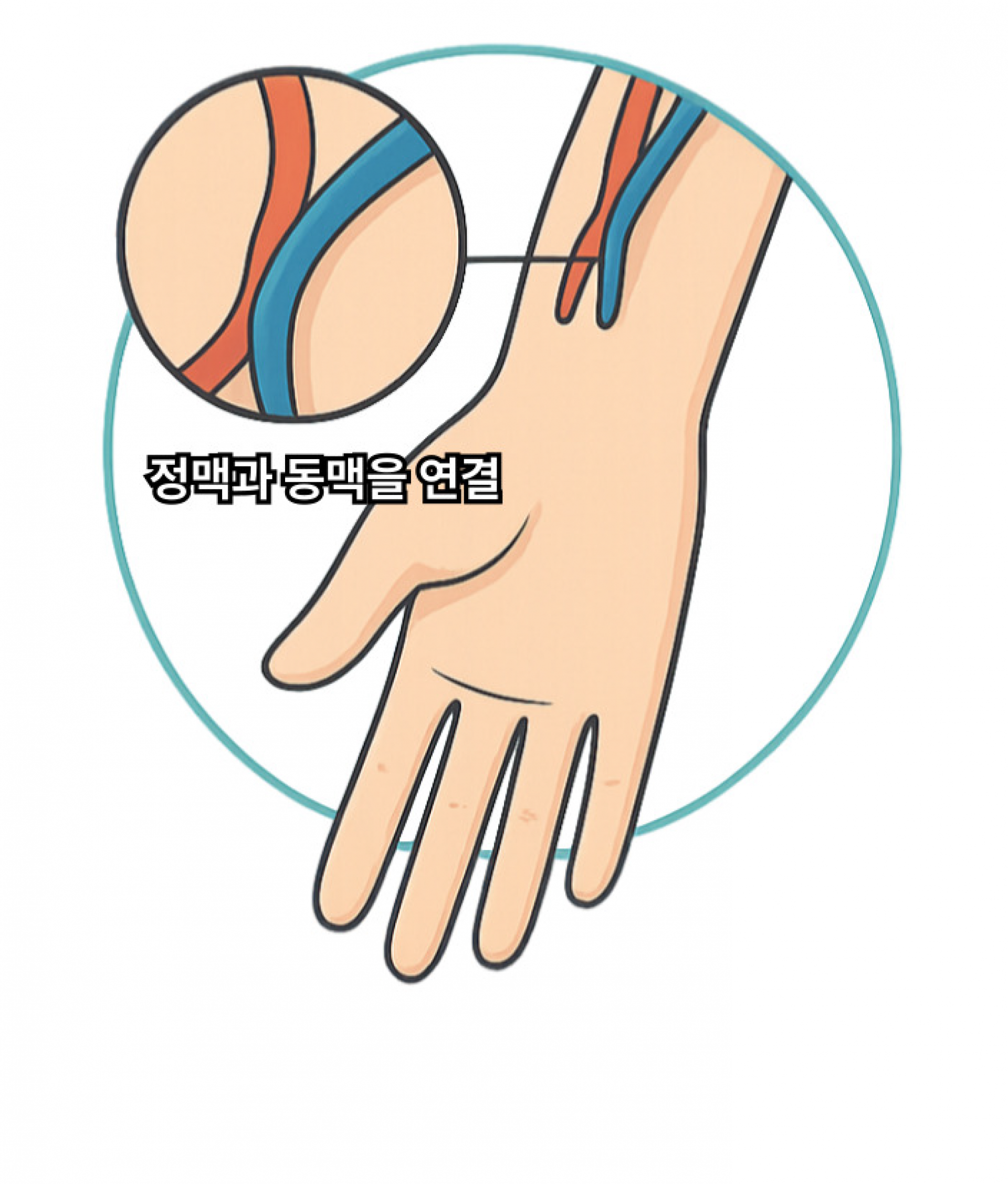 자가혈관조성술