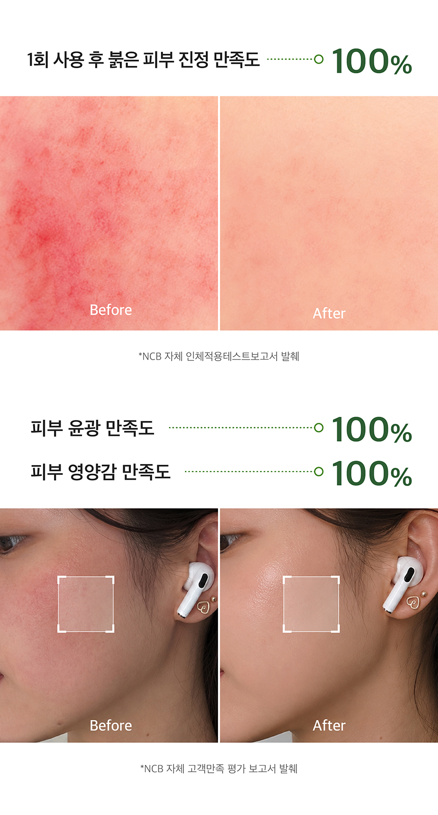 (NEW)쑥 진정 앰플