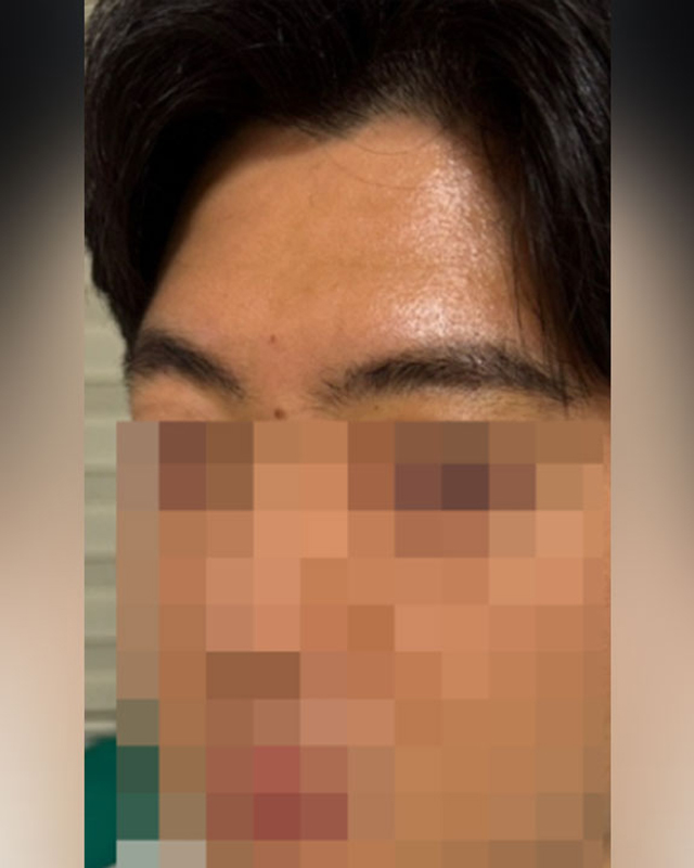 After Image