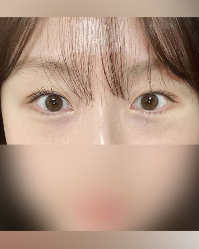 After Image
