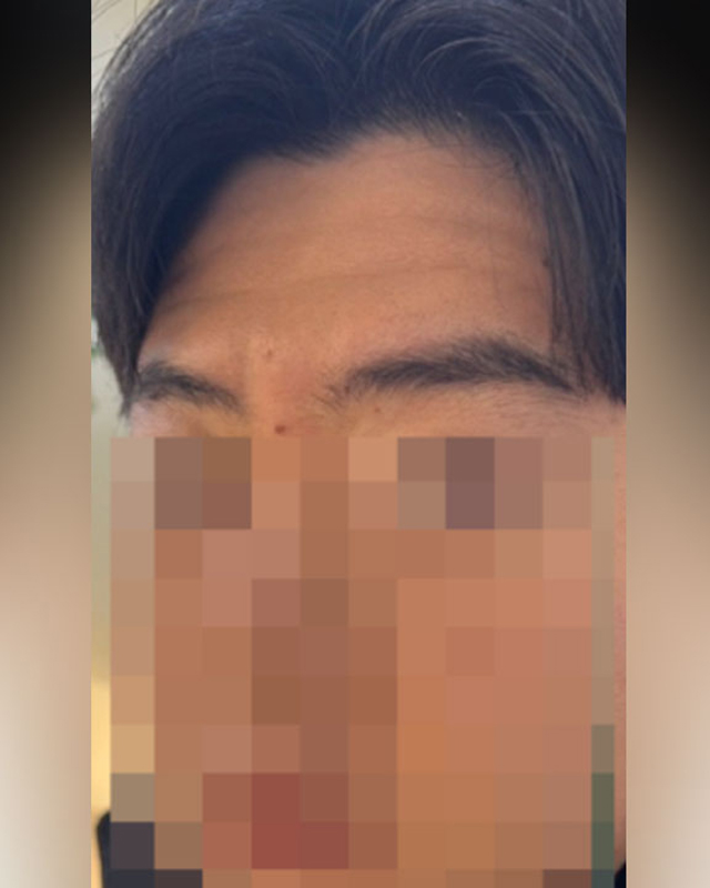 Before Image