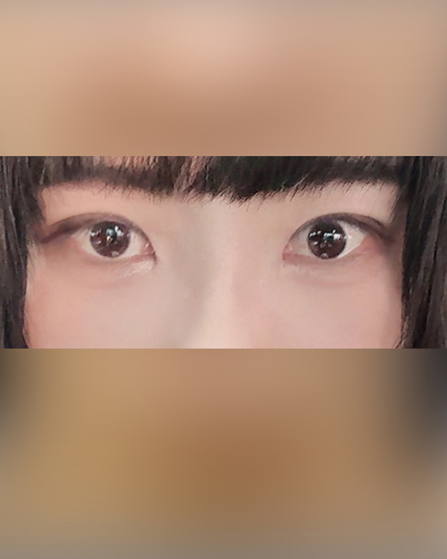 After Image