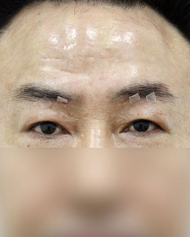 After Image