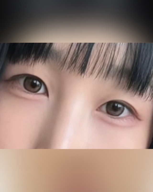After Image
