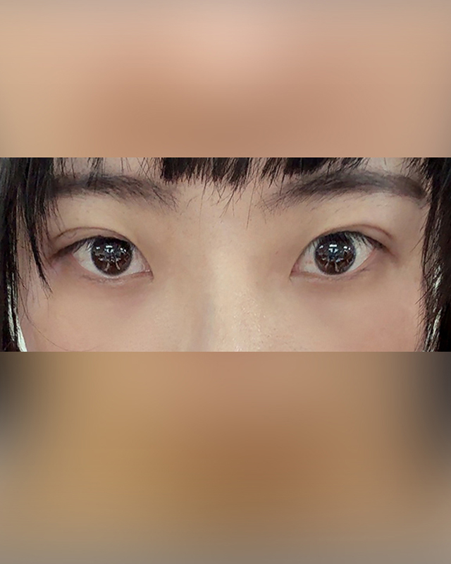 Before Image