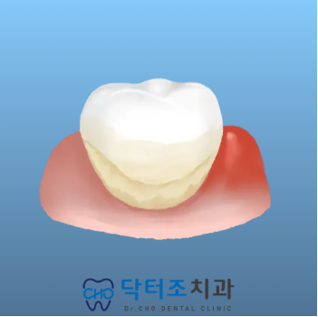 연1회스케일링