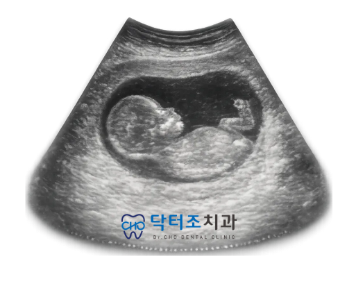 아기 초음파 그림