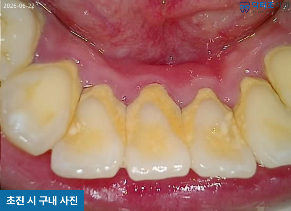 50대스케일링