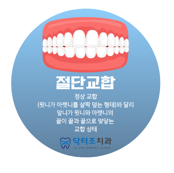 절단교합