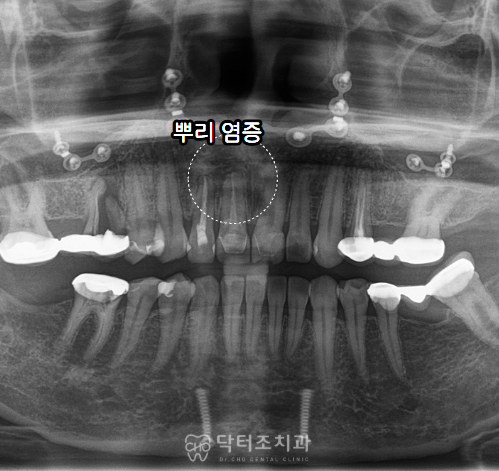 a4963682cfdfd.png