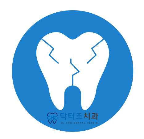 치아균열치료