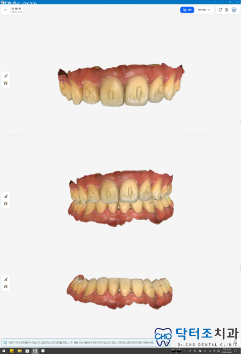 유지장치스캔