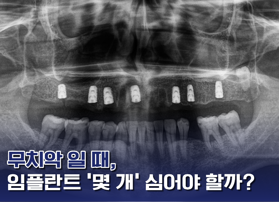 무치악환자의 파노라마