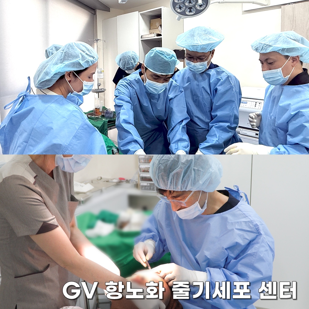 GV줄기세포