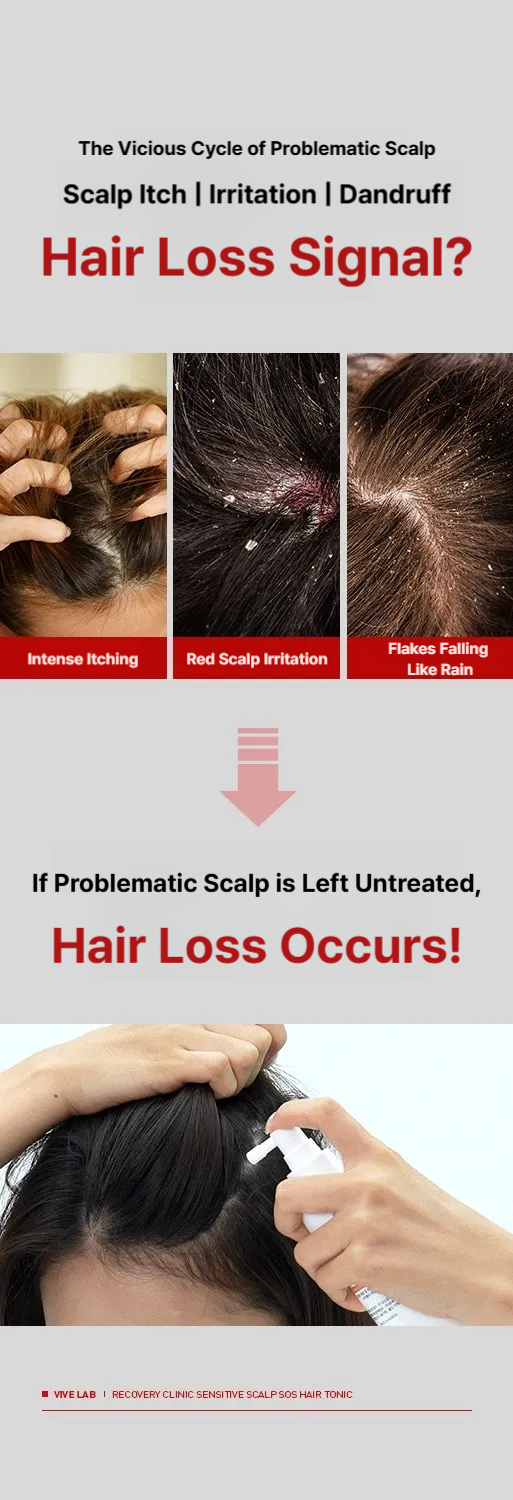 Vive Lab Recovery Clinic Sensitive Scalp SOS Solution Hair Tonic
