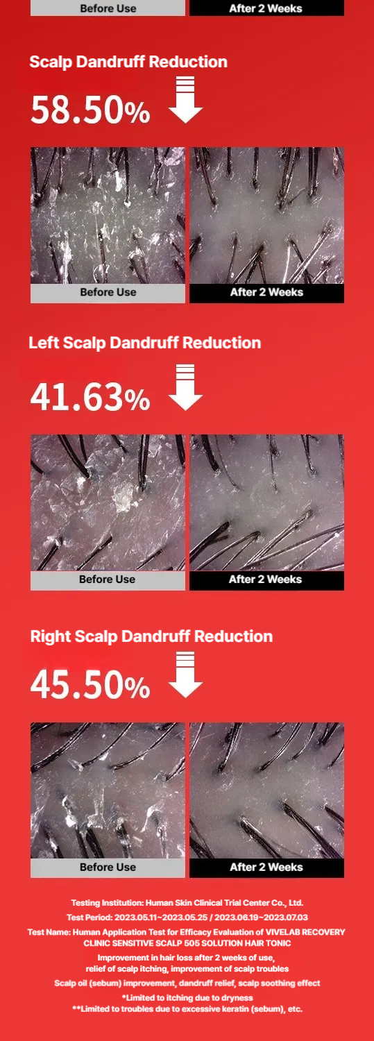 Vive Lab Recovery Clinic Sensitive Scalp SOS Solution Hair Tonic