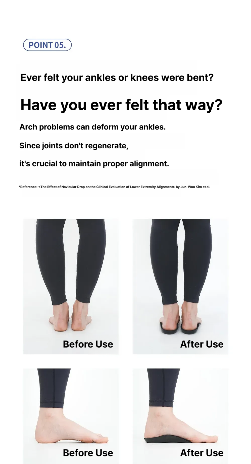 Ventiflexer plantar fasciitis recovery insoles