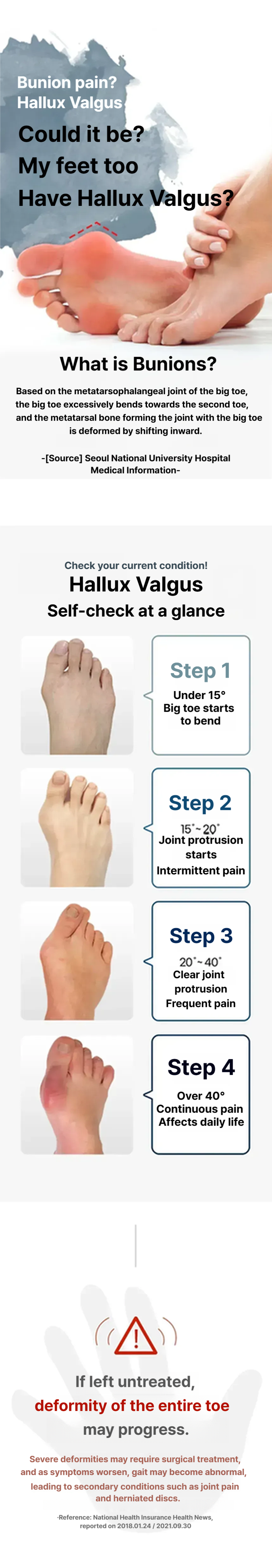 Footband (toe braces)