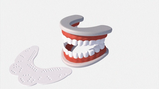 Guardsis tooth grinding mouthpiece (default type)