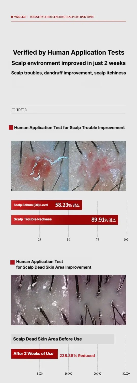 Vive Lab Recovery Clinic Sensitive Scalp SOS Solution Hair Tonic