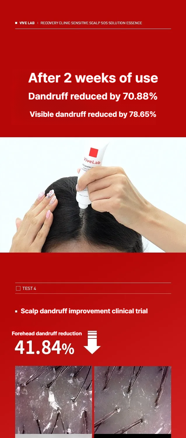 Vive Lab Recovery Clinic Sensitive Scalp SOS Solution Essence