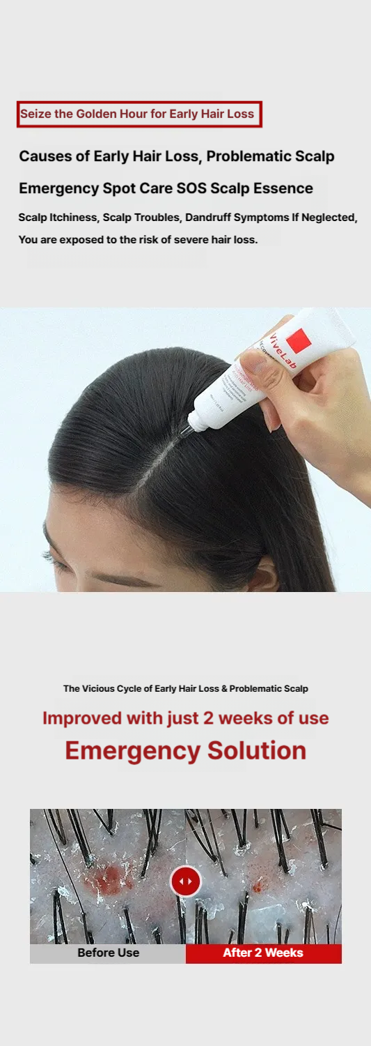 Vive Lab Recovery Clinic Sensitive Scalp SOS Solution Essence