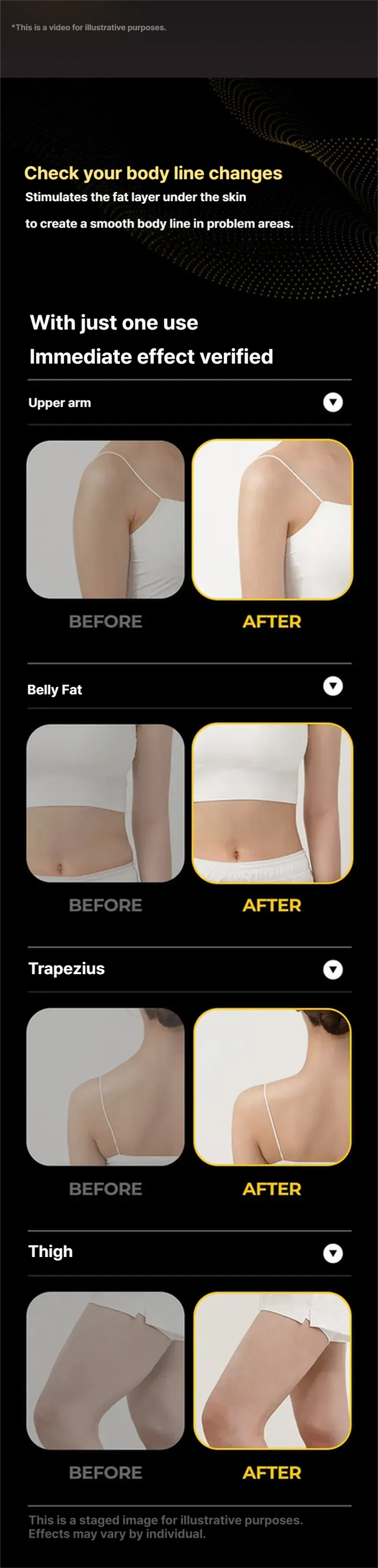 CALO EMS Slimmaker