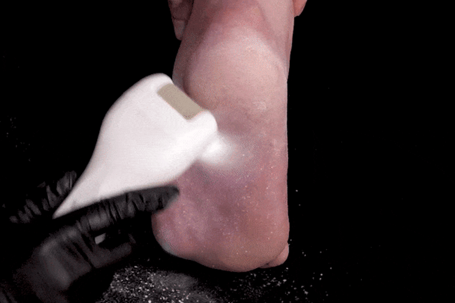 Facefactory Diapeel DECORATIVE REMOVING MACHINE
