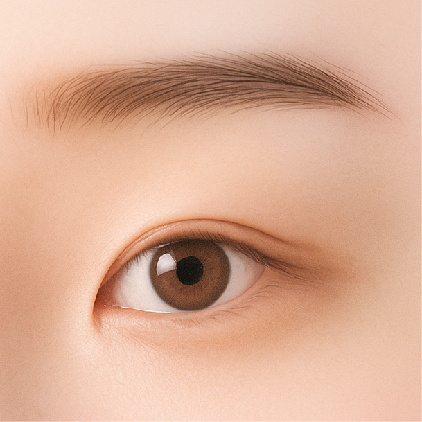 뒤트임 수술방법 01