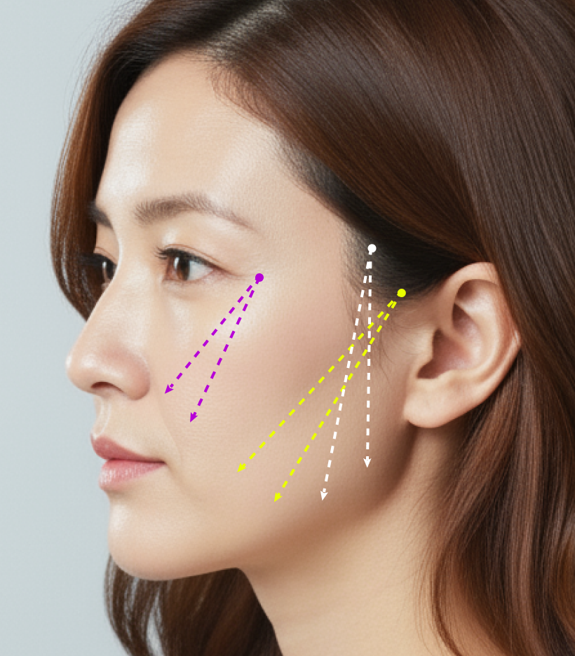 퀵트리 부위별 디테일 - 기본형