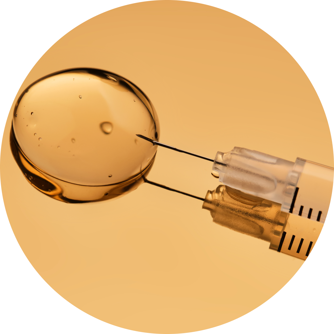 보톡스/필러 포인트3 - 부산 쁘띠/기타성형