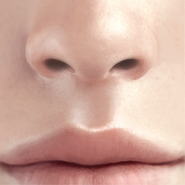 인중축소술 수술방법 04