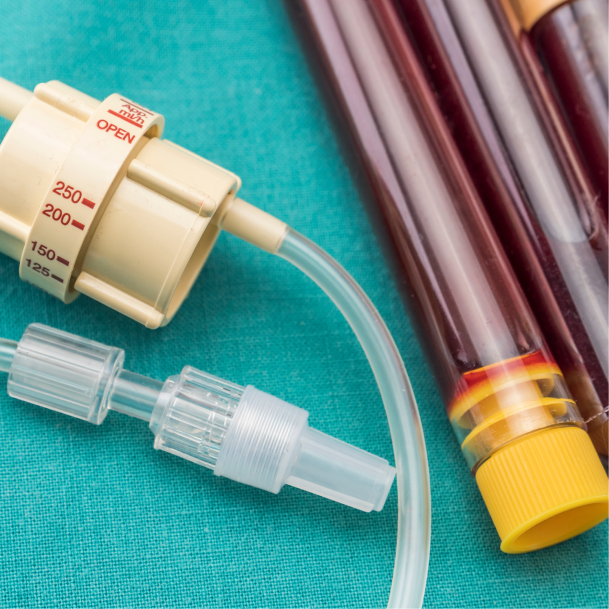 지방흡입 수술방법02