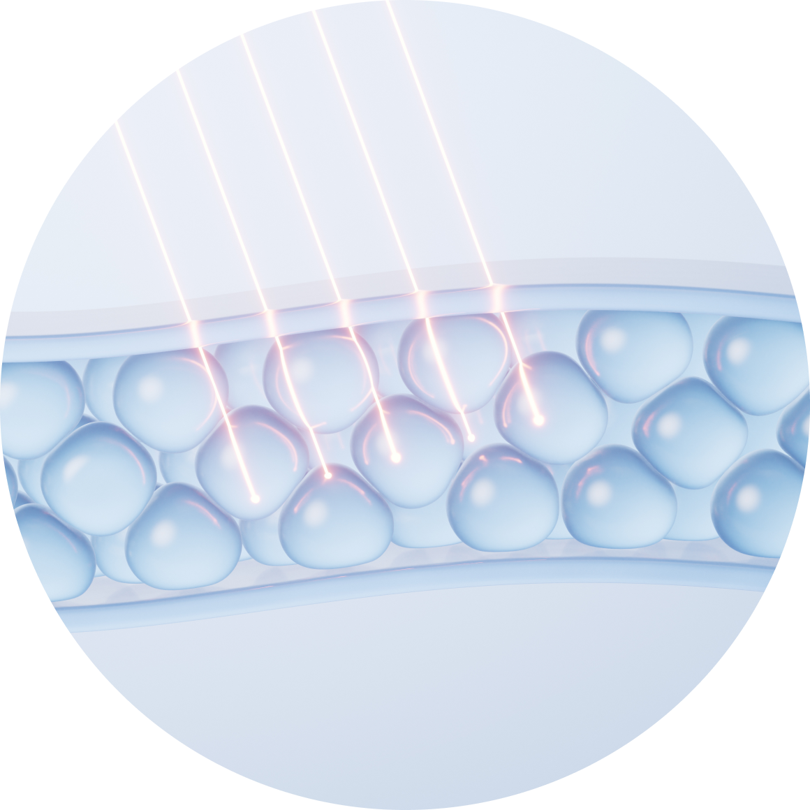 세르프 포인트3 - 부산 레이저리프팅