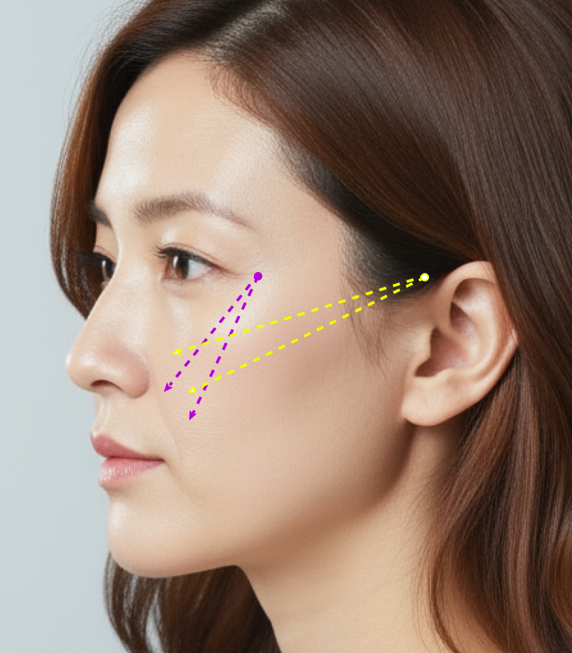 퀵트리 부위별 디테일 - 중앙면강화형