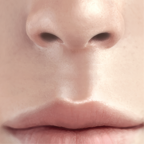 인중축소술 수술방법 01