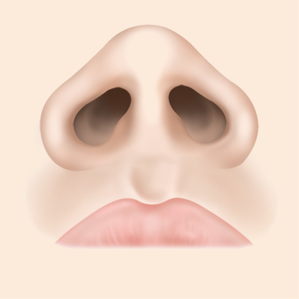 콧볼축소술 비절개 수술방법 01