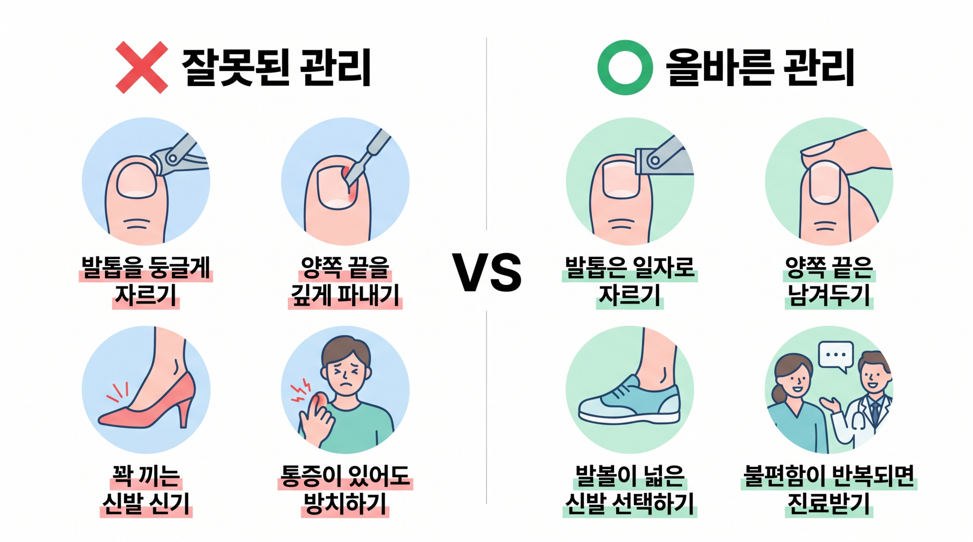 내성발톱 잘못된 관리와 올바른 관리 방법 비교 인포그래픽