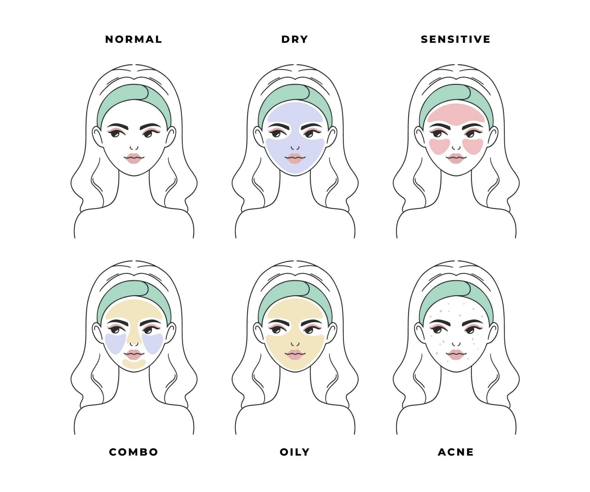 피부타입별 특징, 수부지와 구별점